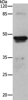 KRT15 Antibody[35625]