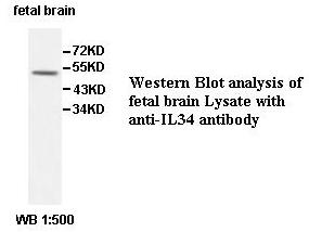 IL34 Antibody[39576]