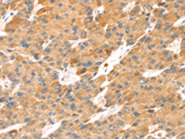 TNFSF15 Antibody[43164]