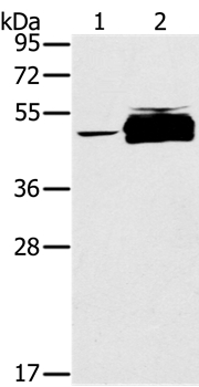 PTPN20B Antibody[37850]
