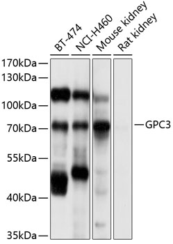 GPC3 Rabbit Polyclonal Antibod