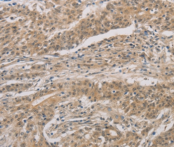 DDIT4 Antibody[36407]