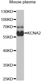 KCNA2 antibody[38802]