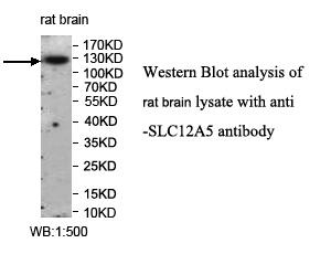 SLC12A5 Antibody[39959]