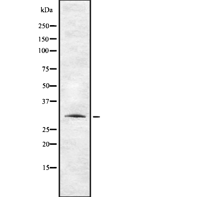 TAS2R12 Antibody[44622]