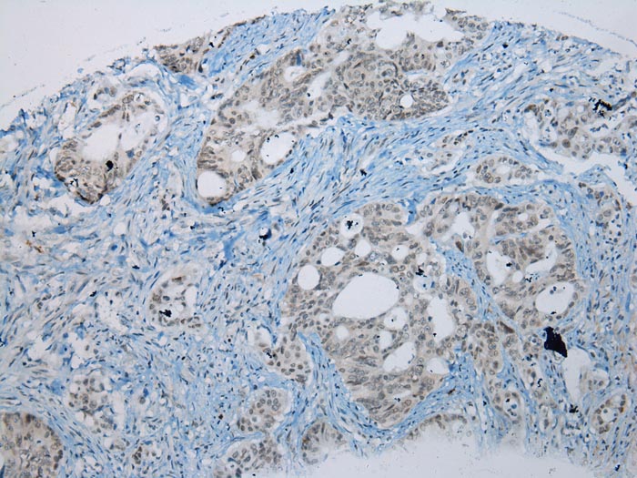 UBE2I Antibody[43252]