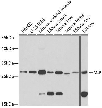 AQP0 antibody[38479]