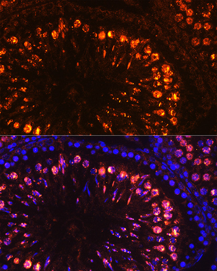 Hist1h1t Rabbit Polyclonal Ant