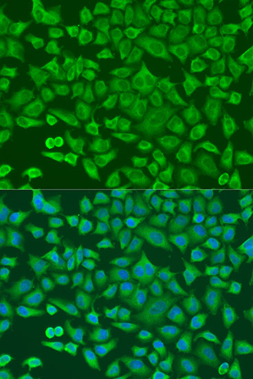 ALB Rabbit Polyclonal Antibody
