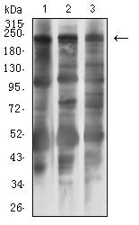 MYLK Mouse mAb[63977]