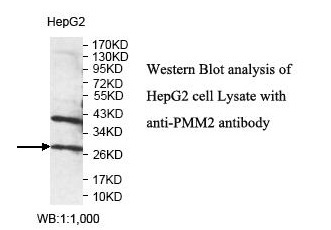 PMM2 Antibody[39827]