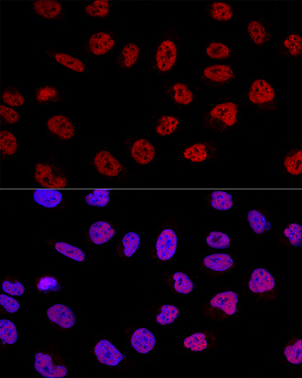 BCAS2 Rabbit Polyclonal Antibo