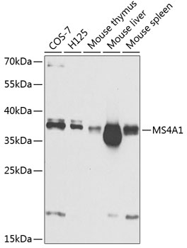 MS4A1 antibody[38300]