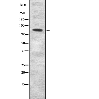 SEMA3F Antibody[45393]