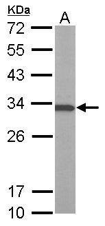 ATP6V1E1 Antibody[35378]