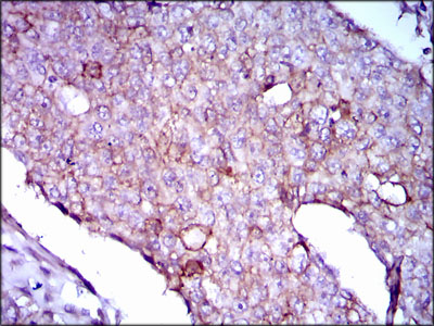 LPA Antibody[48474]