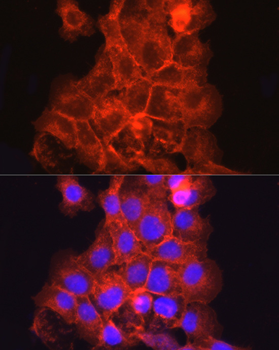 THBD Rabbit Polyclonal Antibod