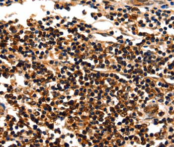 MYOZ1 Antibody[35825]