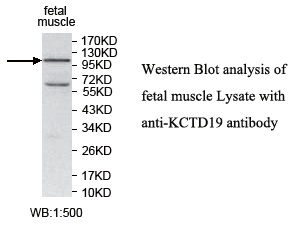 KCTD19 Antibody[39740]