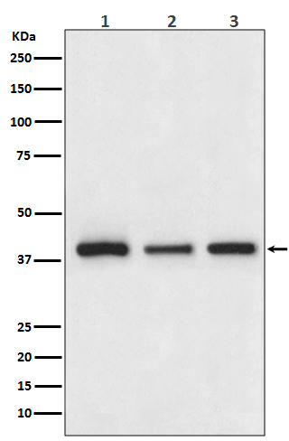 Cathepsin L/V/K/H Rabbit mAb[5