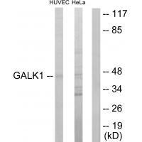 GALK1 Antibody[33795]