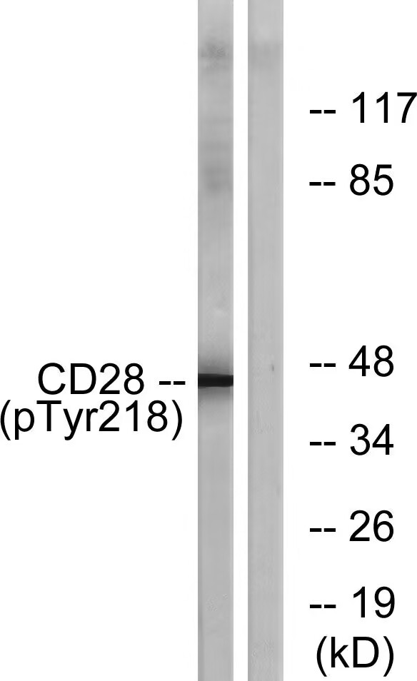 CD28 (Phospho-Tyr218) Antibody