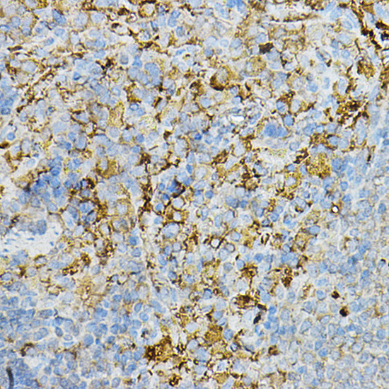 IRAK4 antibody[38750]