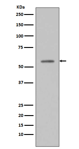 p53 (Phospho-Ser33) Rabbit mAb