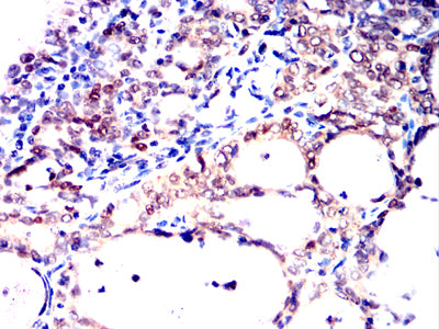 HNF1B Mouse mAb[63742]