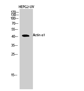 Actin α1 Polyclonal Antibody[4