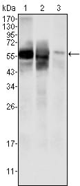 Glucose-6-phosphate isomerase 
