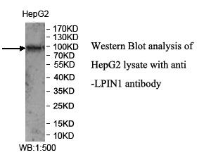 LPIN1 Antibody[39971]
