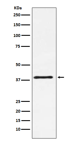 CTLA4 (CD152) Rabbit mAb[56275