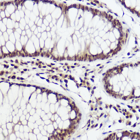 WBP11 Rabbit Polyclonal Antibo