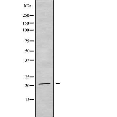 TRAPPC5 Antibody[46279]