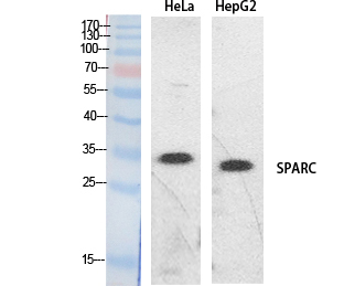 SPARC Polyclonal Antibody[4189