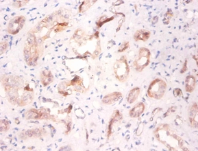 V-type proton ATPase subunit F
