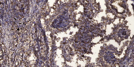 PLC β2 Polyclonal Antibody[483