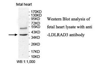 LDLRAD3 Antibody[39887]