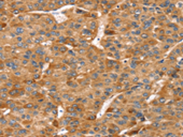 RFFL Antibody[42731]