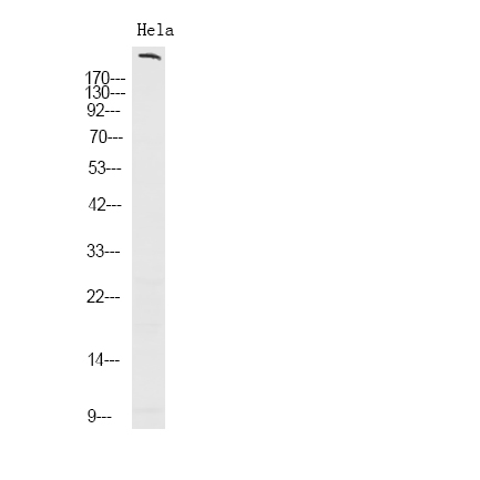 ROS (Phospho-Tyr2274) Antibody