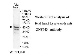ZNF643 Antibody[39824]