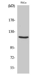 PR Polyclonal Antibody[44262]