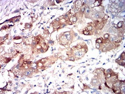 ASGR2 Mouse mAb[63093]