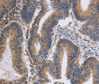ITPR1 Antibody[37665]
