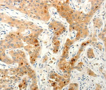 FAT4 Antibody[37293]