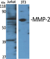 MMP-2 Polyclonal Antibody[4115