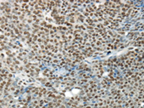 HNRNPM Antibody[43188]