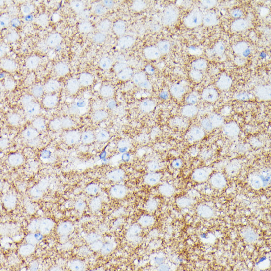SNCG Rabbit Polyclonal Antibod