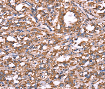 SPAST Antibody[37577]